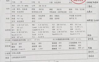 青岛苏州工业园区入职体检